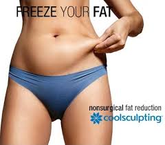 CoolSculpting Fat Reduction