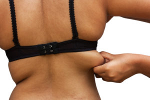 Bra Line Lift Pittsburgh, PA  Beleza Plastic Surgery & Medical Spa