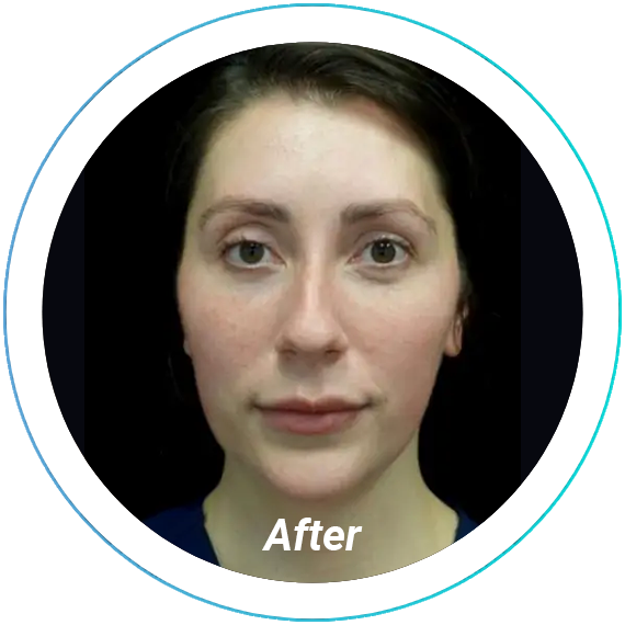 before and after