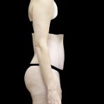 Tummy Tuck Before & After Patient #24618